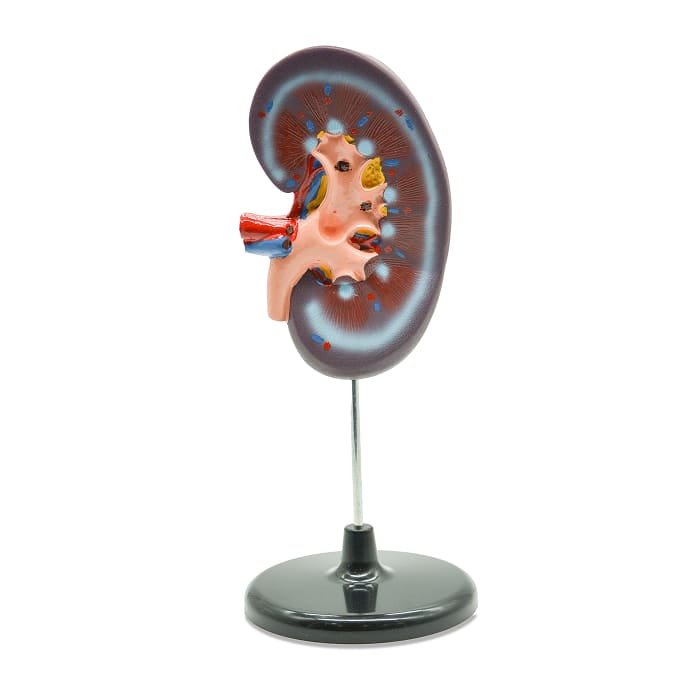 Модель «Почка в разрезе» Модель «Почка в разрезе»